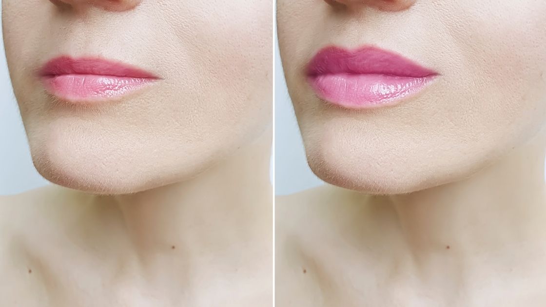 Add Plumpness to Lips