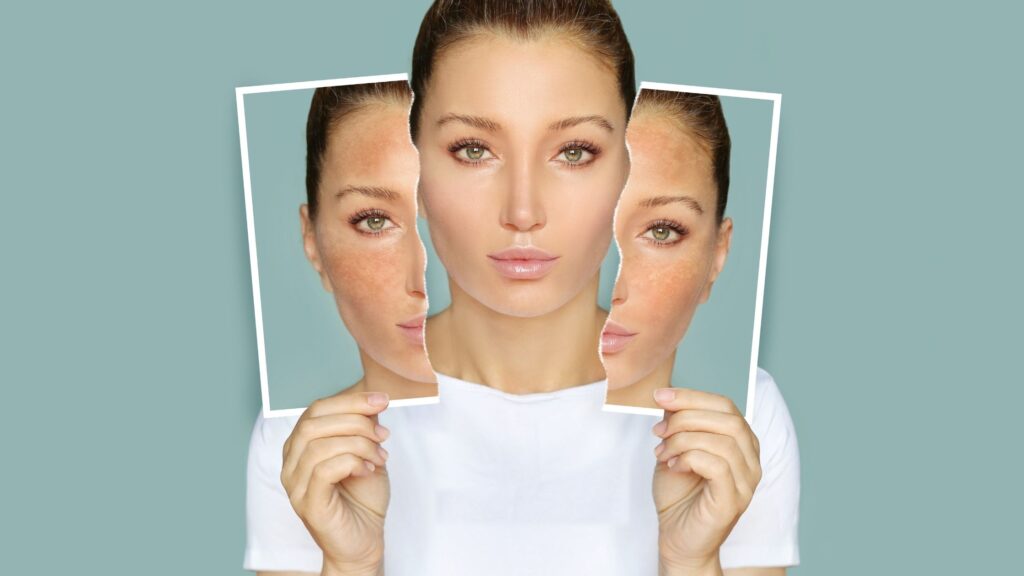 Skin Lightening Treatments