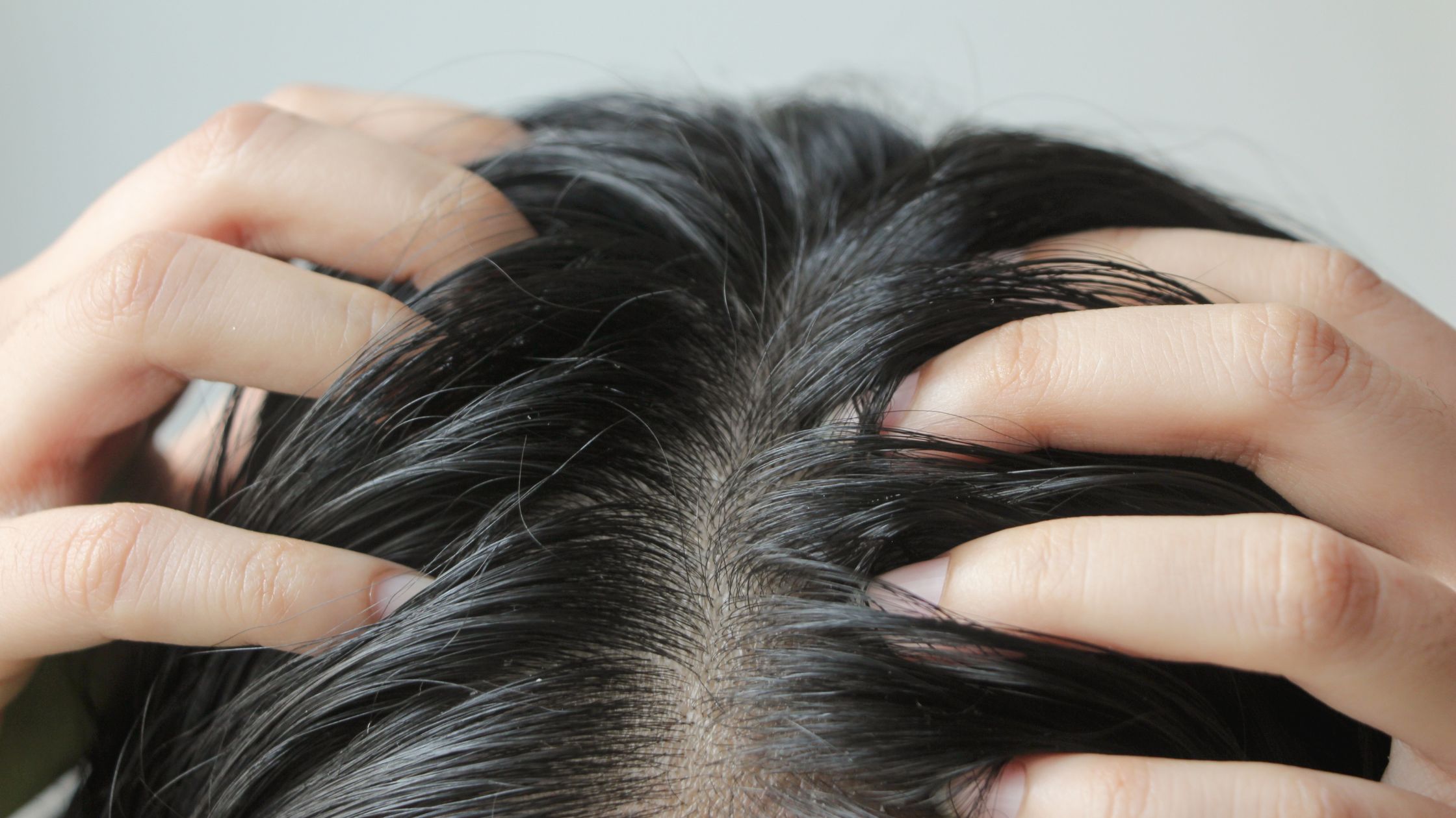 The Ultimate Guide to Treating an Itchy Scalp Dr.Renu Dermatologist
